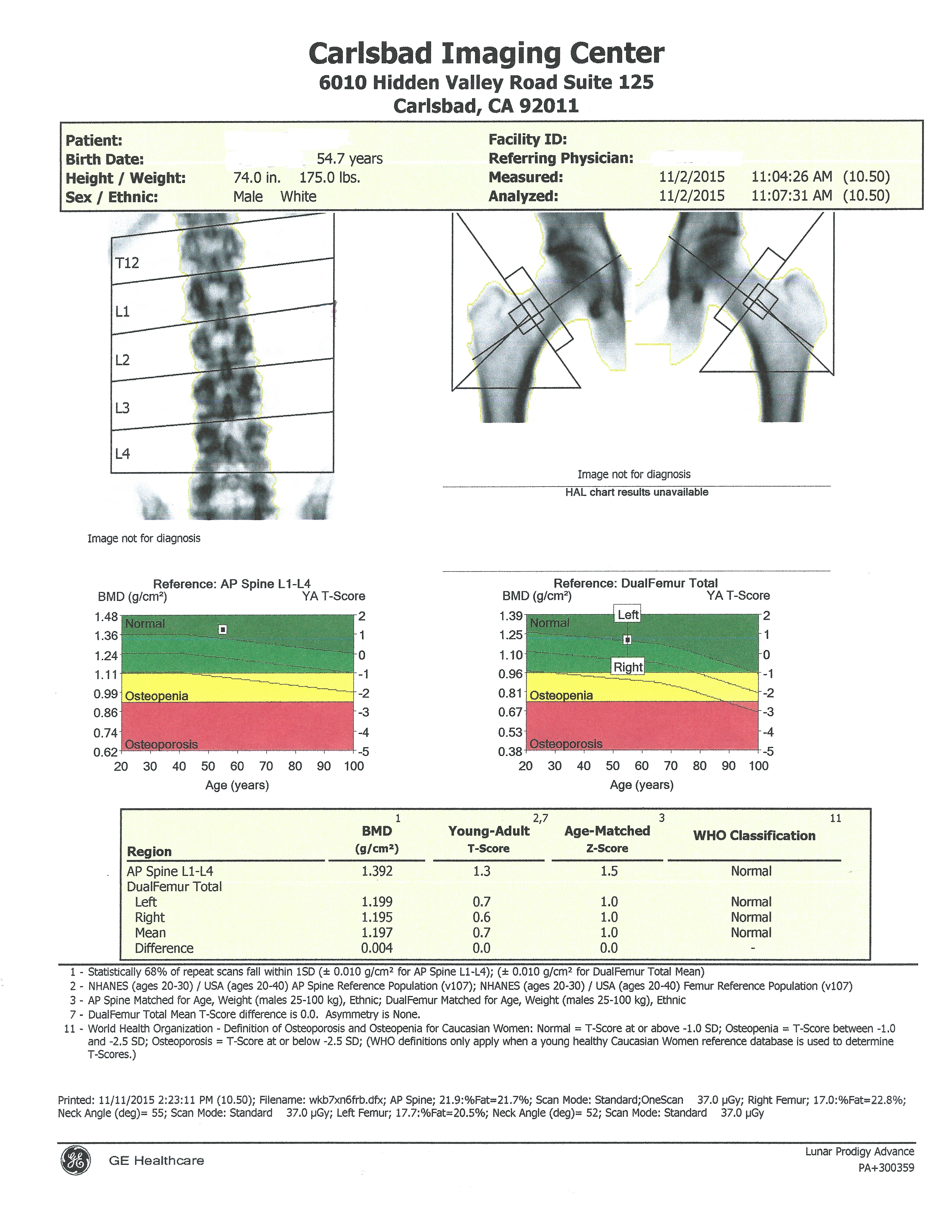 Bone Densitometry/DEXA scan Carlsbad Imaging Center Imperial Radiology