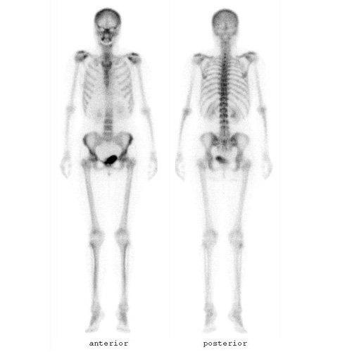 NUCLEAR MEDICINE - Carlsbad Imaging Center - Imperial Radiology