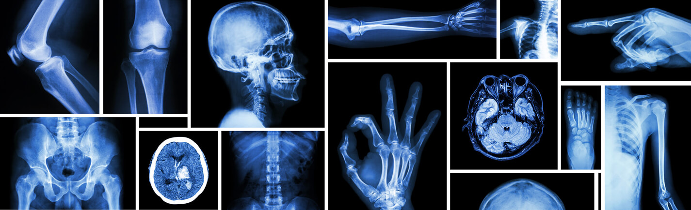 X-Ray - Carlsbad Imaging Center - Imperial Radiology