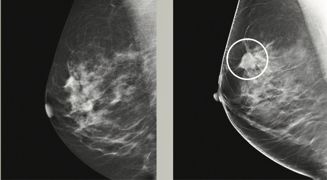 3D Mammography (Imperial Radiology Location) - Carlsbad Imaging Center -  Imperial Radiology